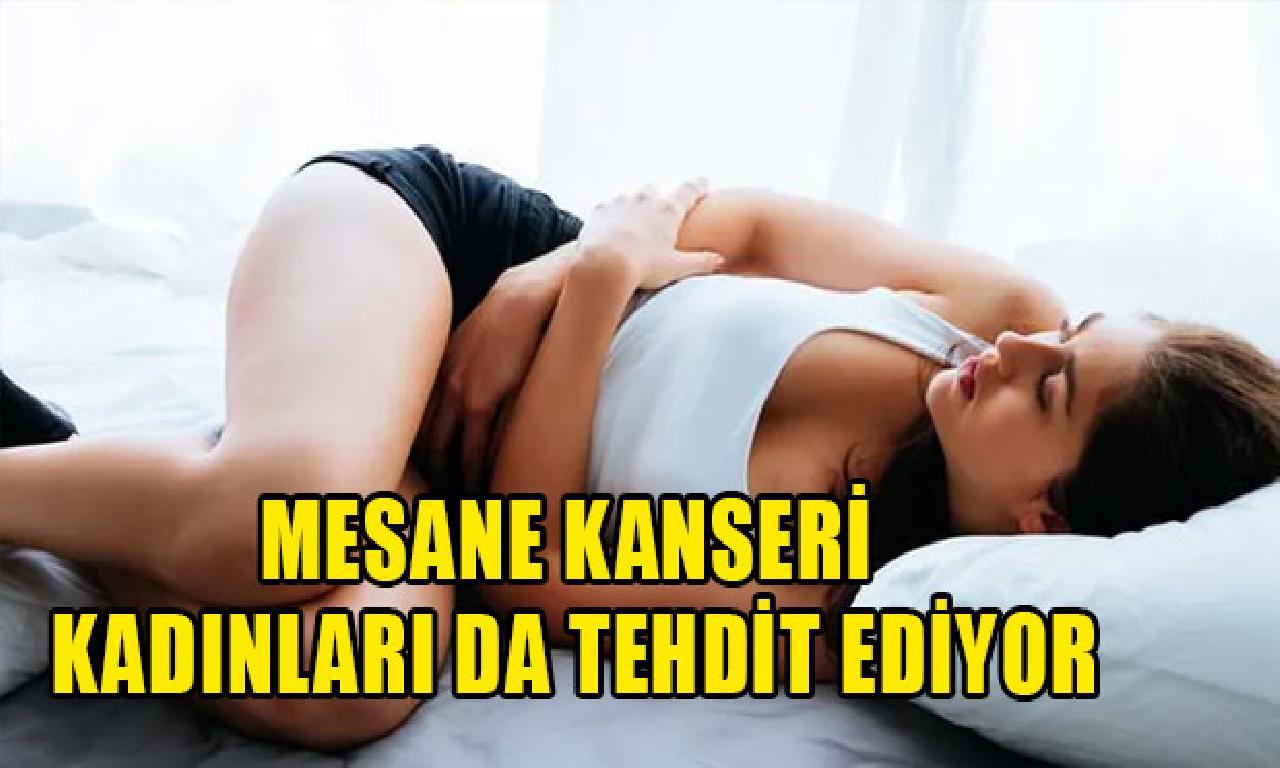 Mesane kanseri kadınları bile gözdağı ediyor 