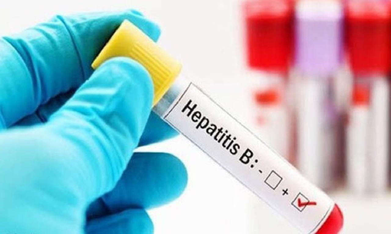 Hepatit Hastalarının Pandemi Sürecinde dahi Tedaviyi Aksatmaması Kritik Önem Taşıyor 