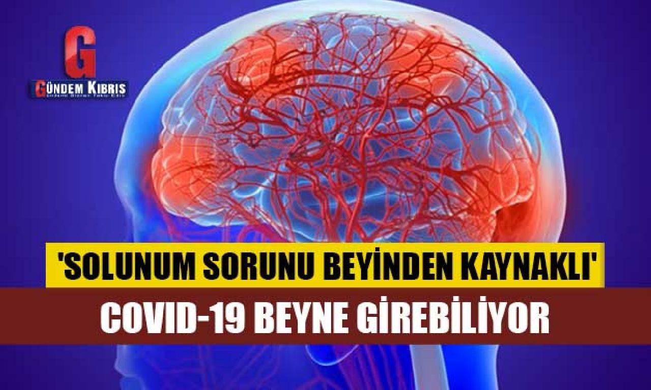 Araştırma: Covid-19 beyne girebiliyor 