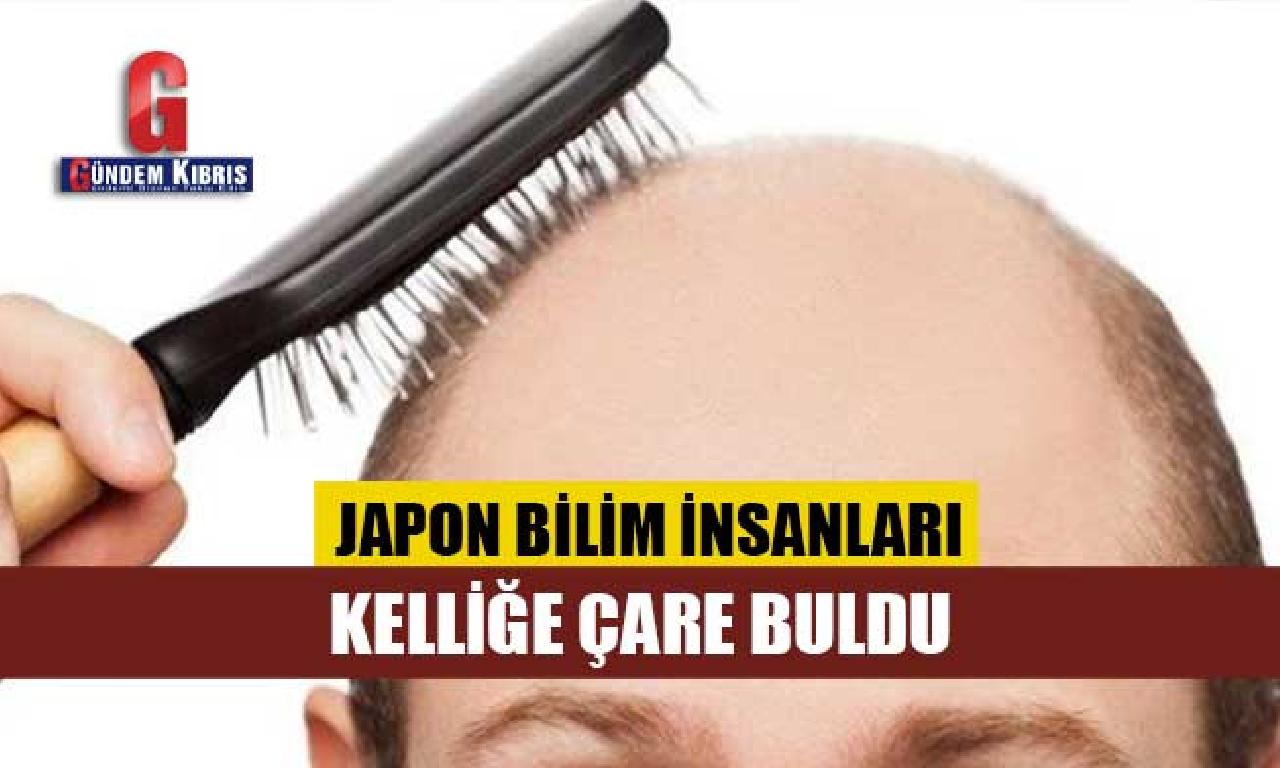 Japon ilim insanları kelliğe çare önemli 