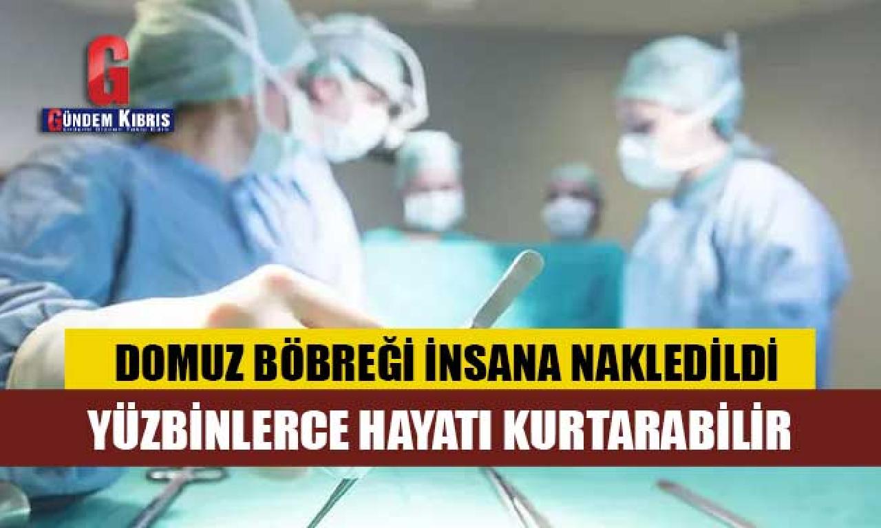 Organ naklinde çığır açacak gelişme 