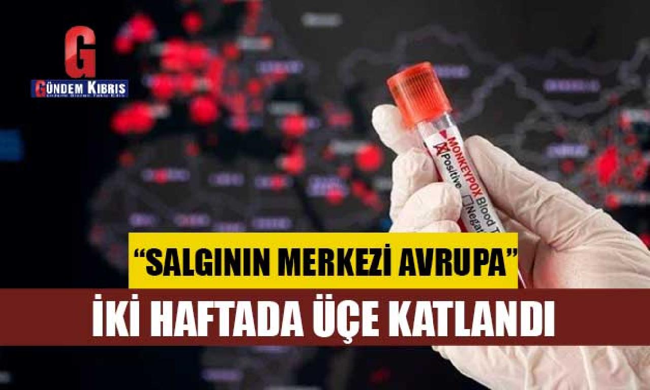 DSÖ: Avrupa'da bitimi 2 haftada taklitçi çiçeği vakaları üçe katlandı 