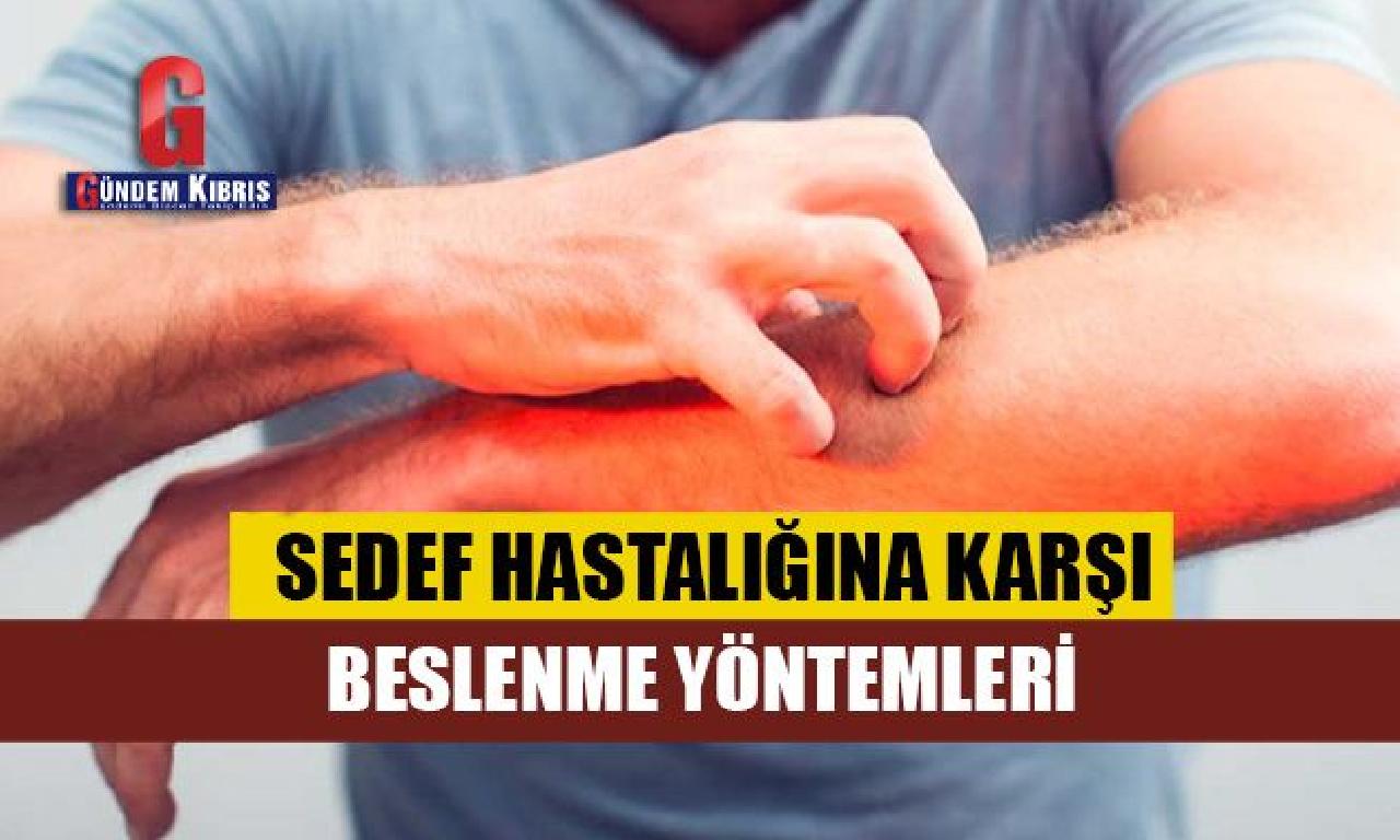 Sedef hastalığına karşı arıcı yöntemleri 