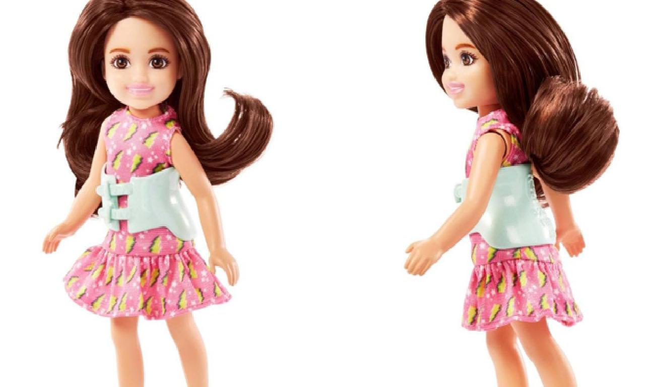 İlk skolyozlu Barbie plâstik piyasaya sürüldü 