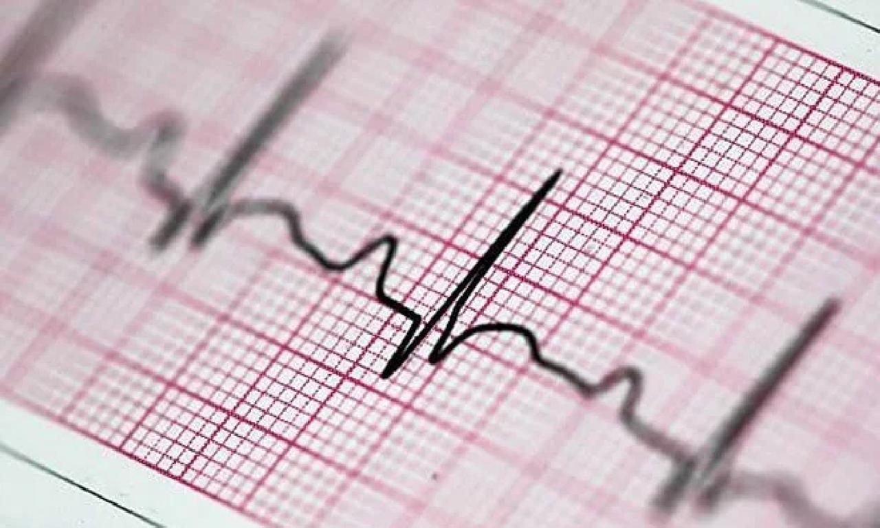 Bilim insanlarından düzensiz yürek atışını belirleme fail kulaklık: 2 yıl içinde EKG'nin sevmek alabilir 