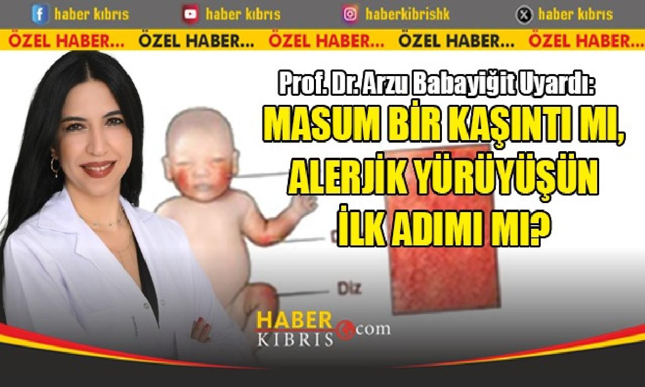 Kaşıntının Arkasında Ne Var? Prof. Dr. Arzu Babayiğit Atopik Dermatiti Anlattı - back